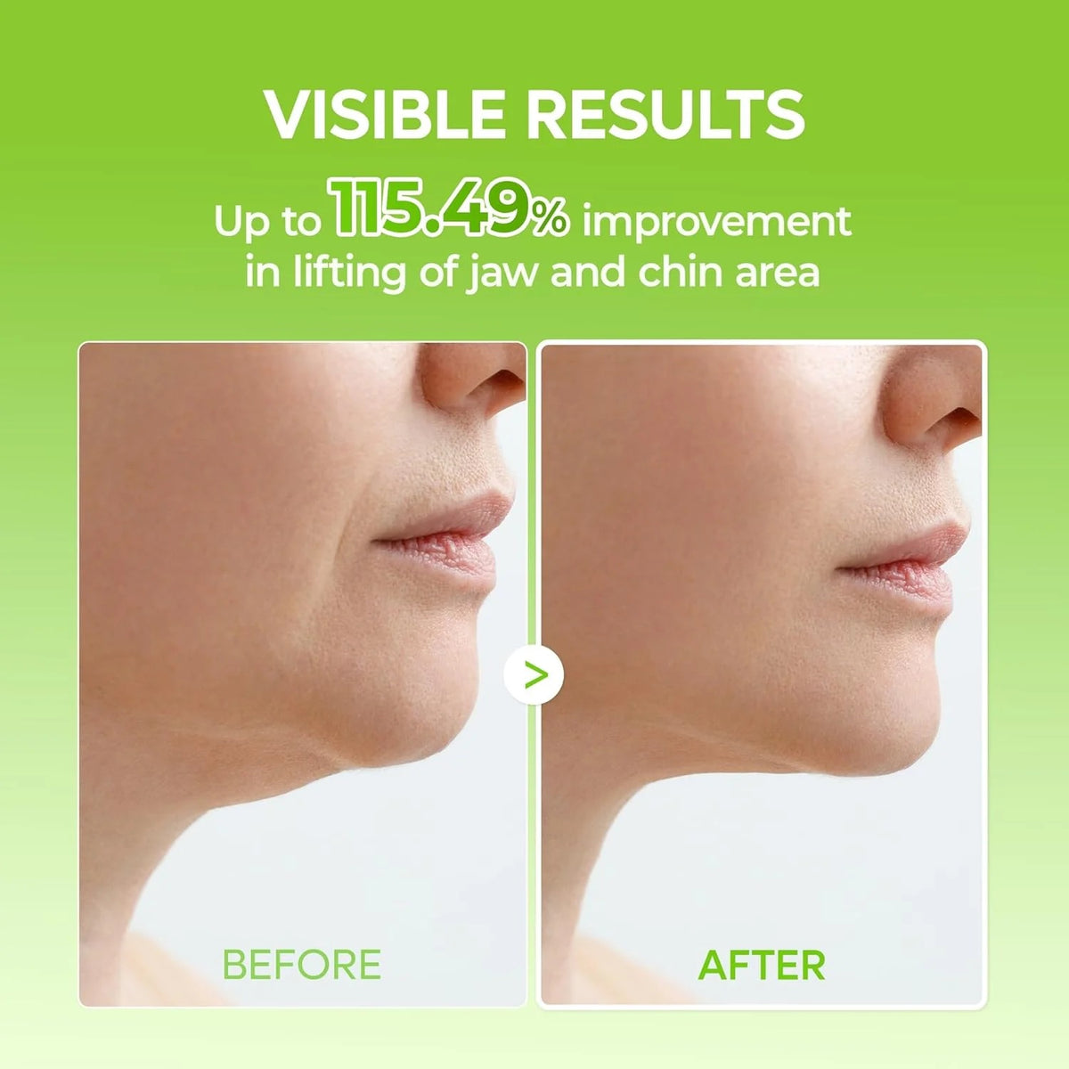 Cactox V-lift band